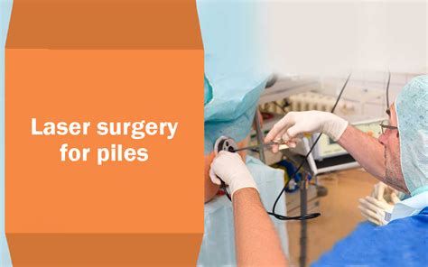 Laser surgery for piles - Blog