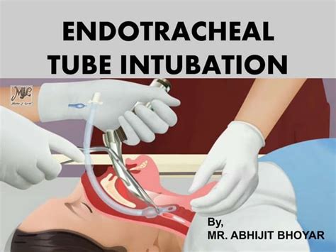 Endotracheal intubation nursing procedure | PPT