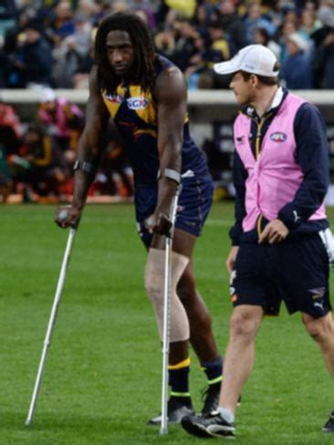 West Coast ruckman Nic Naitanui suffers serious knee injury | PerthNow