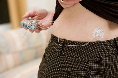 Insulin therapy: Side effects, myths, and tips