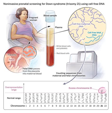 Noninvasive prenatal testing using fetal DNA - Lasker Foundation