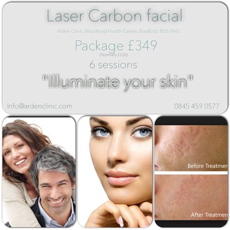 Laser Carbon Facial Package ~ 6 sessions ~ only £349!!! | Laser tattoo ...