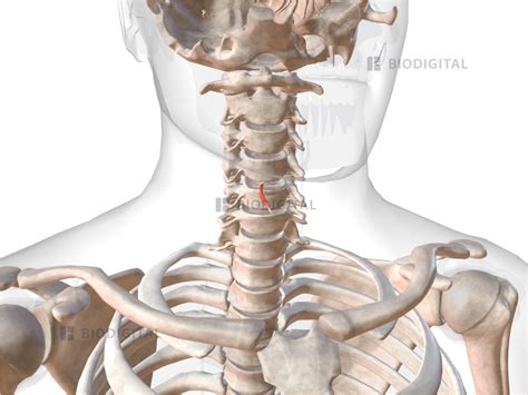 Right lateral cricoarytenoid | BioDigital Anatomy