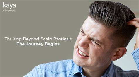 Scalp Psoriasis: Causes, Symptoms And Treatment Options - Blog