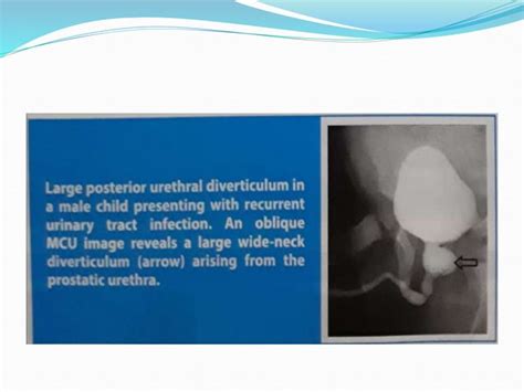 Antegrade & retrograde urethrogram