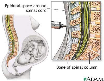 Epidural Analgesia In Labour - FV Hospital