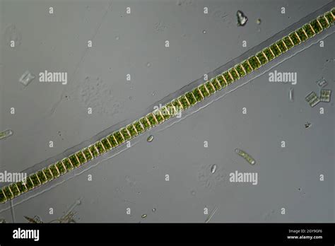 Green algae under the microscope 100x Stock Photo - Alamy