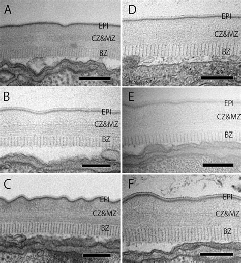 Cuticular structure in Bursaphelenchus xylophilus adults. (A) Female in... | Download Scientific ...