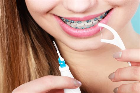 Finding the Right Dental Floss to Use with Braces - Charleston Orthodontics Powered By Smile Doctors