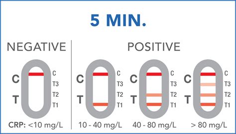 C-Reactive Protein Test | PRIMA Lab SA