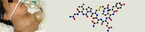 Cretinism - treatment of Cretinism , types Diseases, Index A –Z, medicines, Cretinism symptoms ...