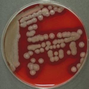 BACILLUS CEREUS - TIPOS DE DOENÇAS GERADAS PELO BACILLUS CEREUS