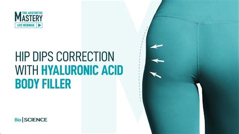 Hip Dips correction With Hyaluronic Acid Body Fillers - YouTube