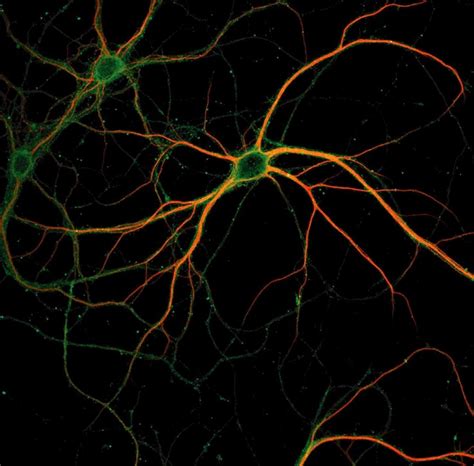 neurons | Neurons, Microscopic photography, Microscopic images