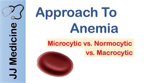 Anemia | Microcytic vs. Normocytic vs. Macrocytic - YouTube