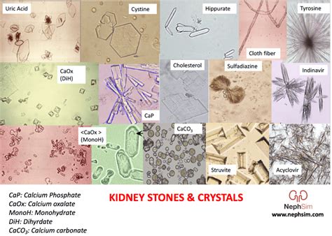 Case 32: Diagnosis & Conclusions - NephSIM