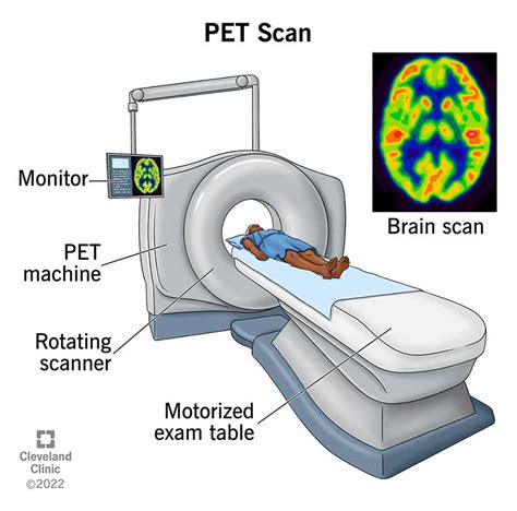 PET Scan: What It Is, Types, Purpose, Procedure & Results