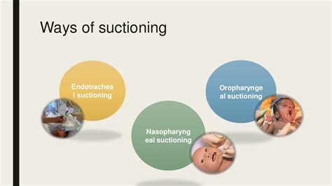 Suctioning -neonates-