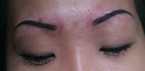 Beauty And The Bees: Eyebrow Has A Scar?