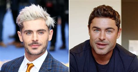 Did Zac Efron Get A Plastic Surgery For His Jaw Before After Look | otakukart