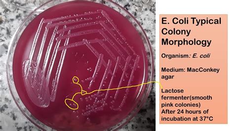 E coli typical colony morphology on Macconkey agar - YouTube