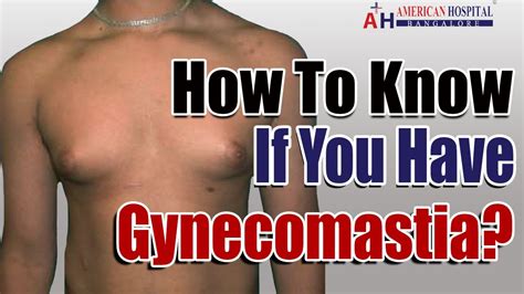 How To Know If You Have Gynecomastia? - 5 Gynecomastia Symptoms! - YouTube