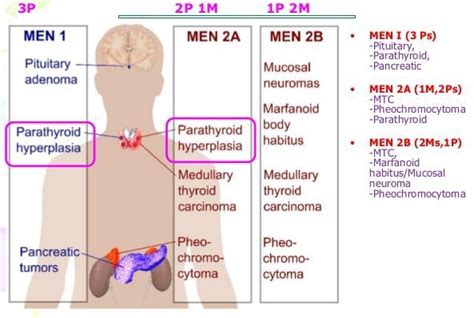 men syndrome Medical Students, Medical School, Neuroma, Mnemonics, Endocrine, Tumor, Thyroid ...