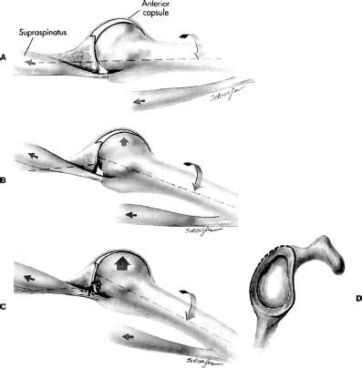 Instability and Laxity | Musculoskeletal Key