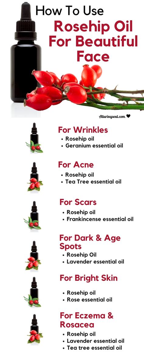 10 Benefits Of Rosehip Oil For Face And How To Use It