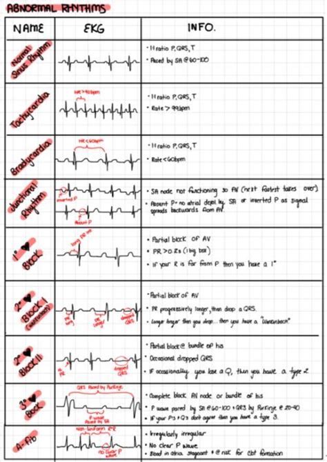 Pin by Gabrielle Rosati on Cardio | Medical school essentials, Medical surgical nursing, Nursing ...