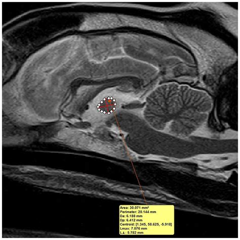 Interthalamic adhesion size in aging dogs with presumptive spontaneous brain microhemorrhages: a ...