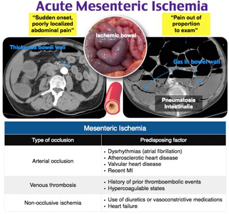 Bowel Ischemia Running at kennethtriker blog