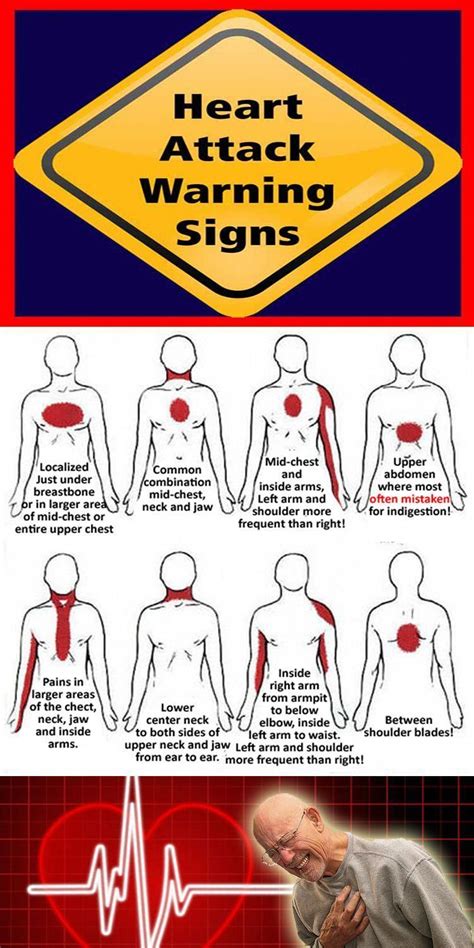 Heart Attack Warning Signs. For illustration only. Symptoms may vary ...