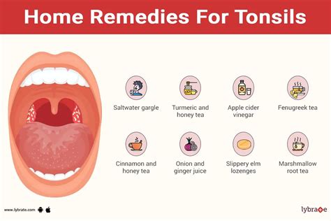 Home remedies for tonsils - By Dr. Rushalli Nair | Lybrate