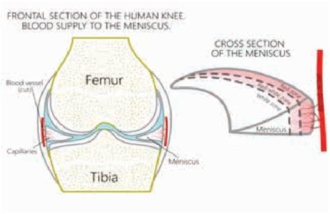 Blood supply of the meniscus by region (Photo source: roadrunner.com ...