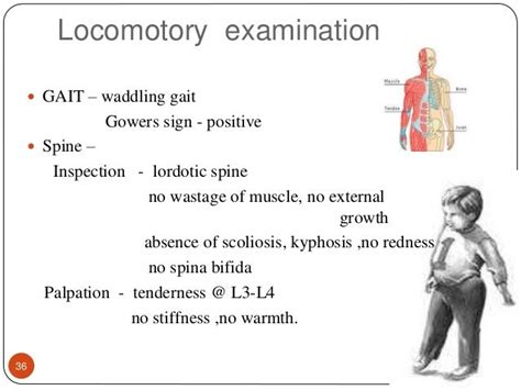 Waddling Gait Toddler Muscular Dystrophy