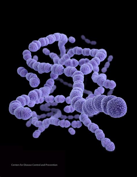 Streptococcus pneumoniae