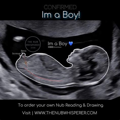 I’m a baby BOY! 💙 many guessed incorrectly on this baby boy! But I got ...