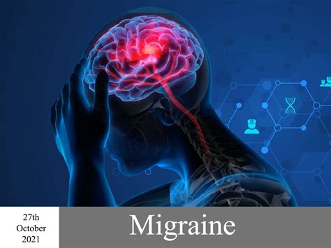 What is Migraine ? Migraine : Causes, Symptoms, and Treatment