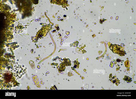 Fungal and fungi hyphae under the microscope in the soil and compost ...