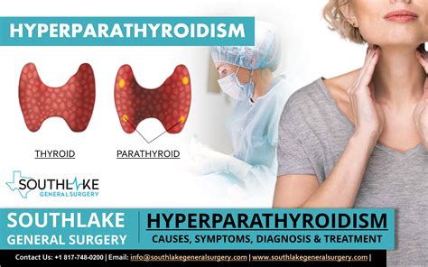 Hyperparathyroidism – Causes, Symptoms, Diagnosis & Treatment