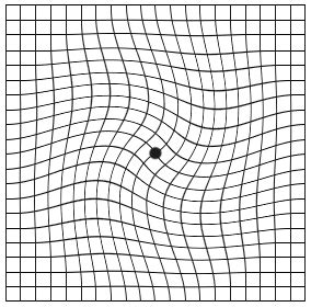 Amsler Grid Test- Retina Ophthalmology Gettysburg PA - Greater Potomac ...