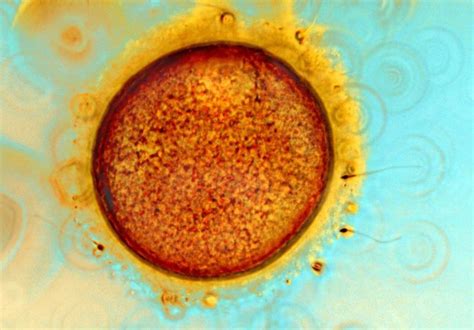 7. An image of light microscope showing several sperms on an egg cell... | Download Scientific ...