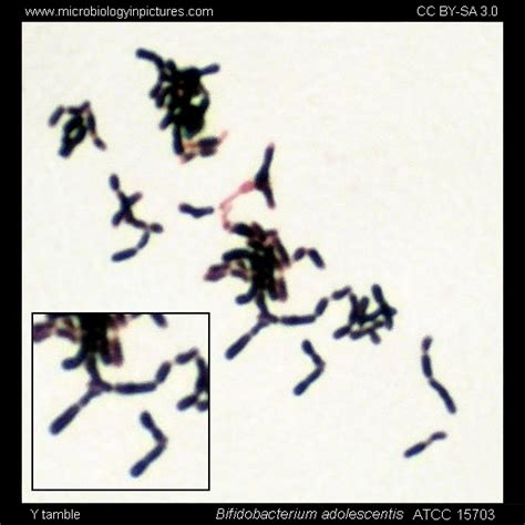 Bifidobacterium Gram-stain and cell morphology. Bifidobacterium micrograph, appearance under the ...