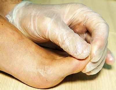 Big Toe Pain Relief | Great Midwest Foot and Ankle Centers