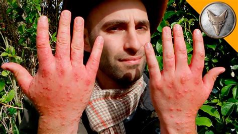 A Compilation of the Most Painful Insect Stings That Wilderness Expert ...