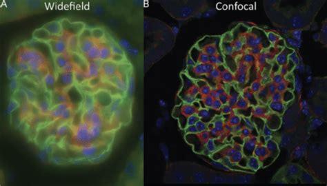 Confocal Microscopy Applications | Axiom Optics.