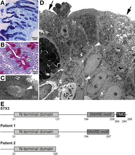 Diapedesis Histology