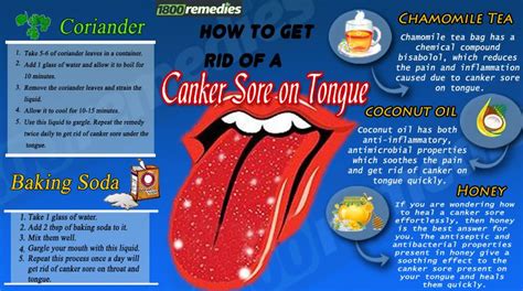 Best 25+ Sore tongue ideas on Pinterest | Sore tongue remedies, Mouth ulcer under tongue and ...