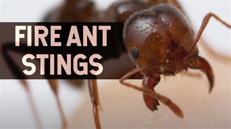 The Science of Ant Stings - Untamed Science